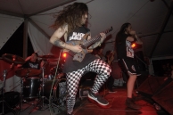 VULVODYNIA